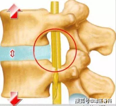 国内反重力跑步机_alterg反重力跑步机官网_0重力跑步机