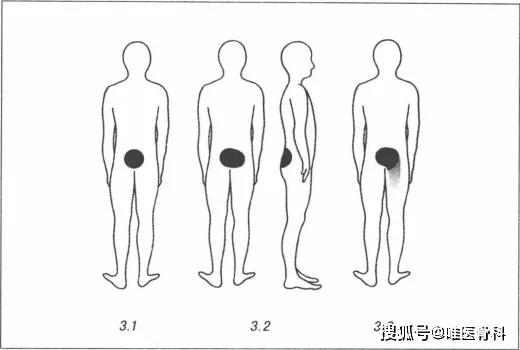 国内反重力跑步机_0重力跑步机_alterg反重力跑步机官网