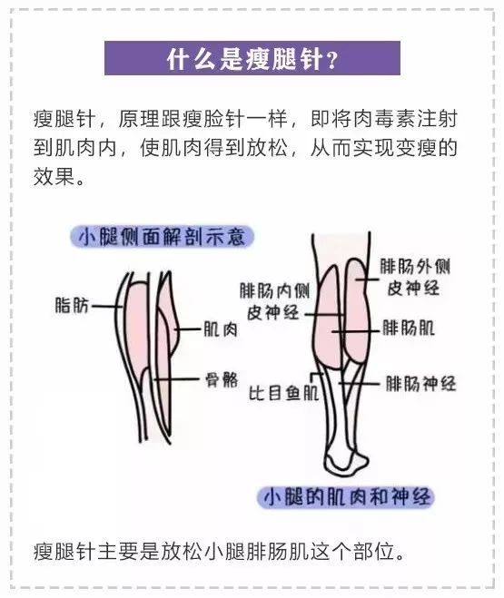 小腿肌肉打过瘦腿针图_肌肉腿打了瘦腿针能保持多久_肌肉瘦腿针会反弹吗