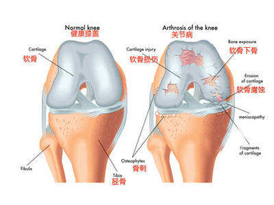 跑步摆腿动作要领_跑步的摆腿训练_跑步后摆腿教学