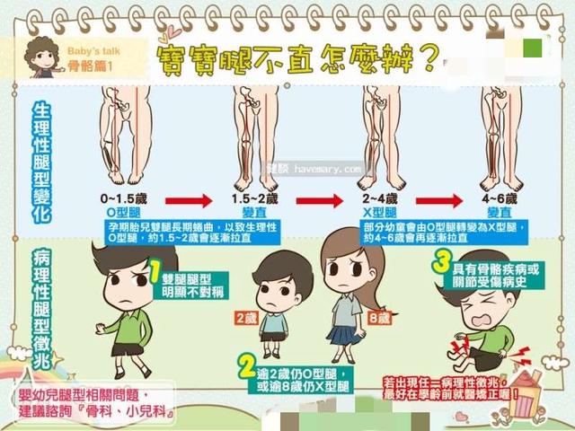 小孩小腿弯曲的正常图_腿弯的小孩_儿童腿弯矫正