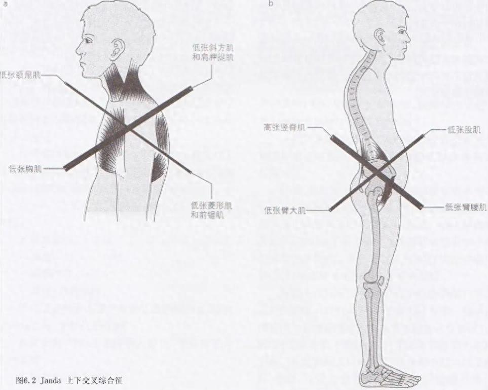 靠墙静蹲能练出肌肉吗_靠墙静蹲能练腹肌吗_靠墙静蹲可以练核心力量吗