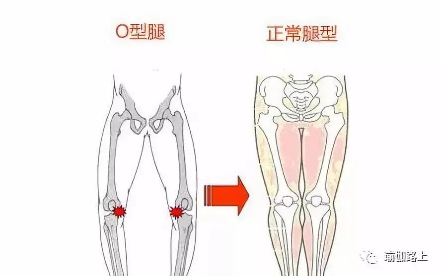 瑜伽改善腿型动作_改善x型腿的瑜伽_瑜伽腿型矫正