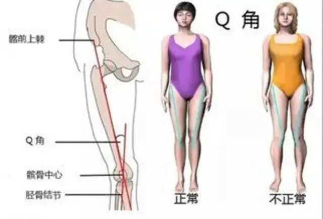 改善x型腿的瑜伽_瑜伽改变腿型_瑜伽腿型矫正